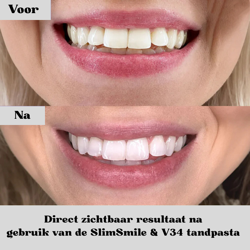 SlimSmile™ – Jouw Witte Lach, In Slechts 30 Seconden Per Dag