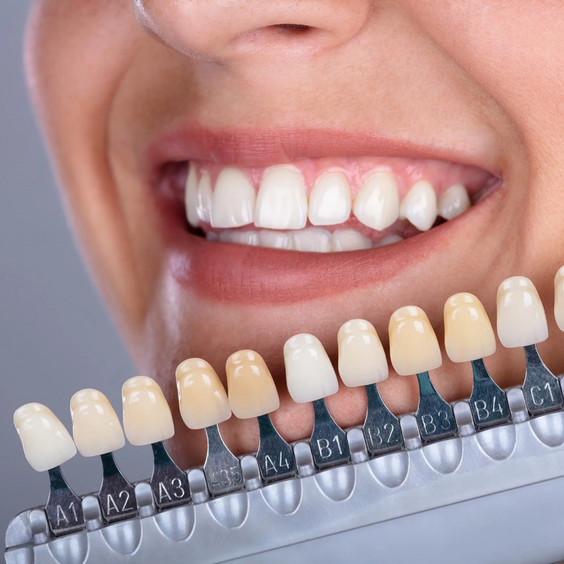 SlimSmile™ – Jouw Witte Lach, In Slechts 30 Seconden Per Dag
